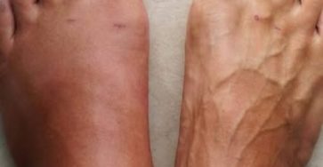 544426994 122186761184488388 8241676789917744275 n