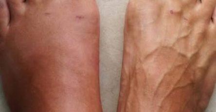 544426994 122186761184488388 8241676789917744275 n