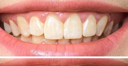 454714962 518340614183094 4570187922054031039 n 768x768 64 40 3