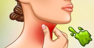 518378161 122289850550007020 7814346307526061532 n