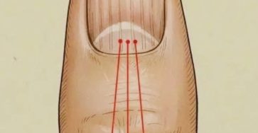 642707944 1479311470254214 2774246492870186402 n