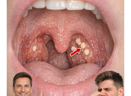 RECETTE COMPLÈTE (55)