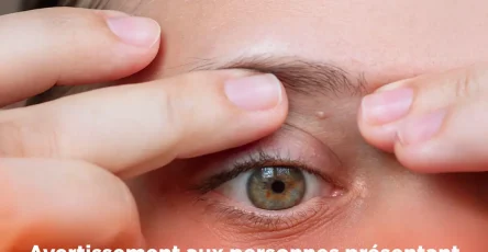 Avertissement aux personnes presentant de petites taches blanches apparaissant sur tout le corps un medecin explique comment sen debarrasser.jpg