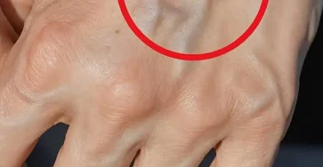 Si vos veines sont visibles en voici la signification 1.jpg