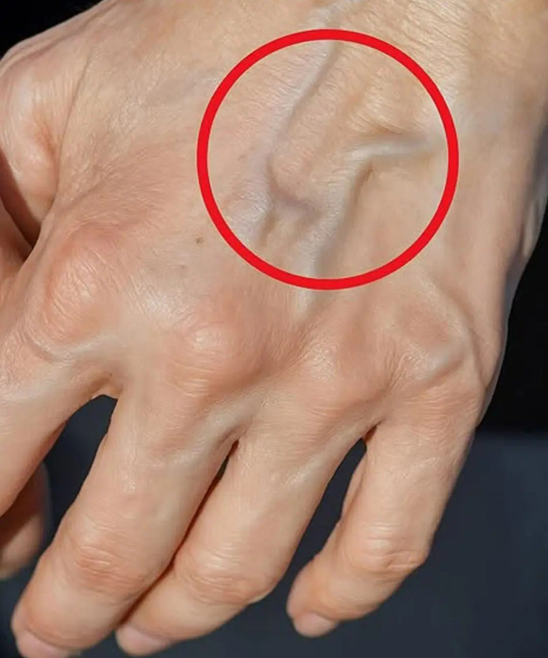 Si vos veines sont visibles en voici la signification 1.jpg