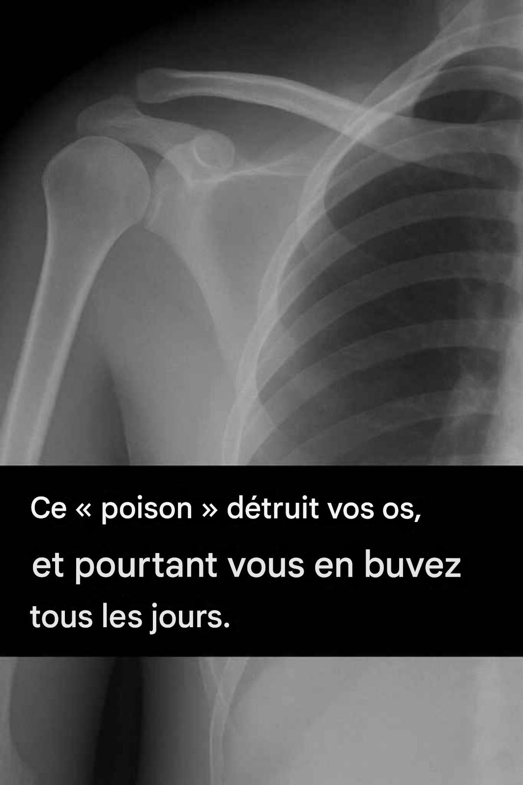 Ce poison detruit vos os – et vous en buvez tous les jours