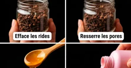 Bienfaits du clou de girofle pour la peau huile de clou de girofle gel de clou de girofle et glacons au clou de girofle.jpg