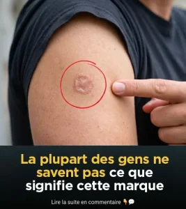 Cicatrice ronde sur votre bras quelle signification.jpg