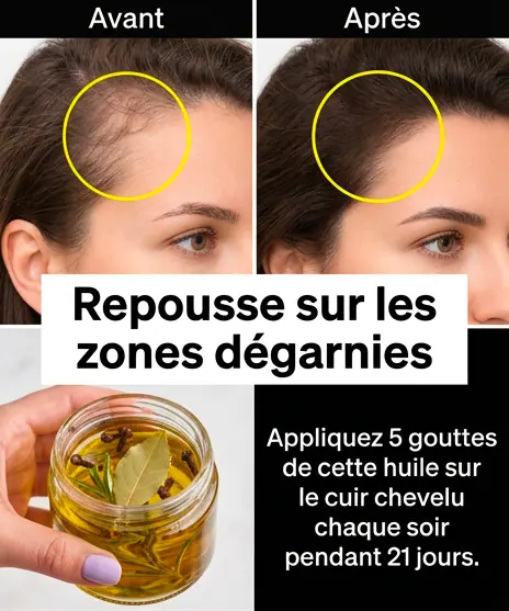 Huile de clou de girofle romarin et laurier faites repousser vos cheveux sur les zones degarnies.jpg