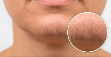 Si vous etes une femme avec des poils au menton voici ce que cela signifie vraiment.jpg