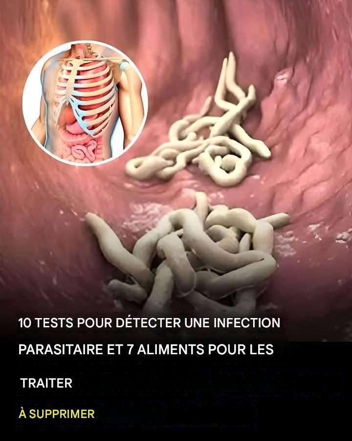 Translated image fr